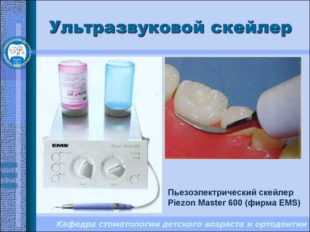 Ультразвуковая чистка зубов: очищение зубной эмали без вреда для здоровья, показания и противопоказания к применению, этапы процедуры, преимущества метода.
