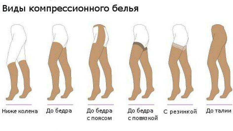 Спасите ваши вены: что такое компрессионный трикотаж и чем он может быть полезен? | 103.by | дзен