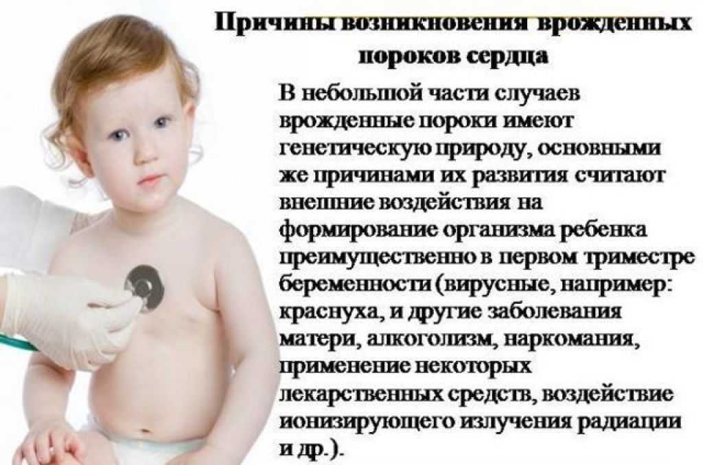 Врожденный порок сердца у новорожденных: симптомы, лечение