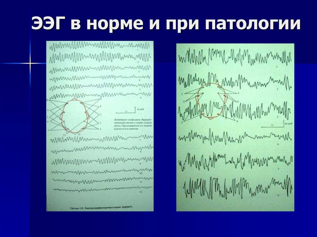 Ээг