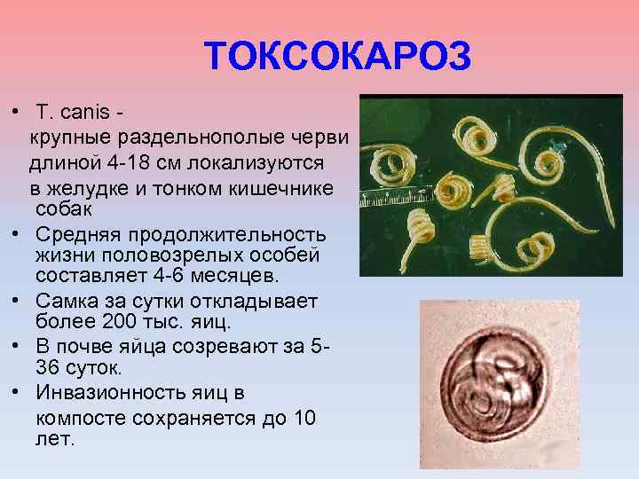 Токсокароз у детей