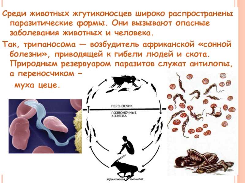 Африканский трипаносомоз человека (сонная болезнь)