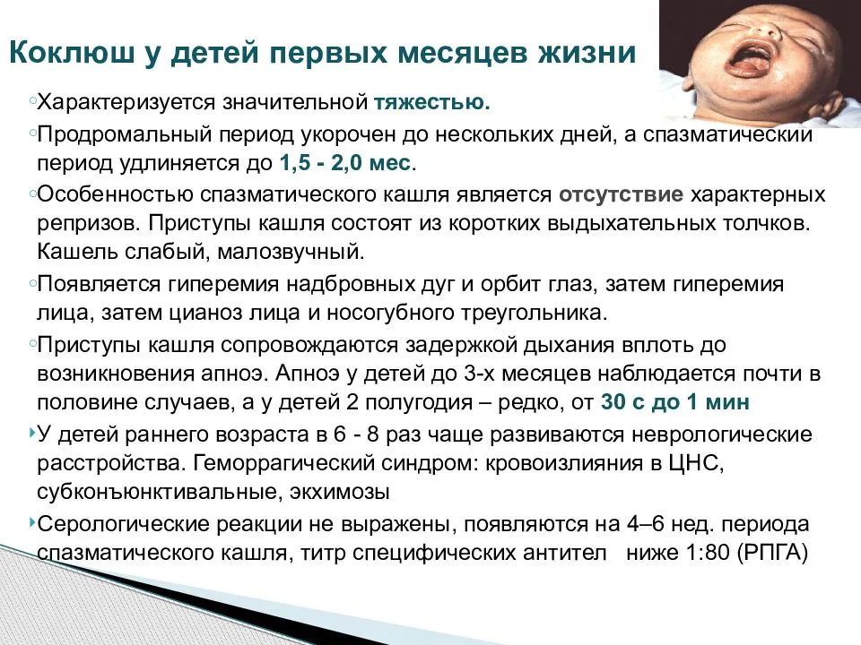 Коклюш: симптомы заболевания. лечение и профилактика коклюша: современные вакцины