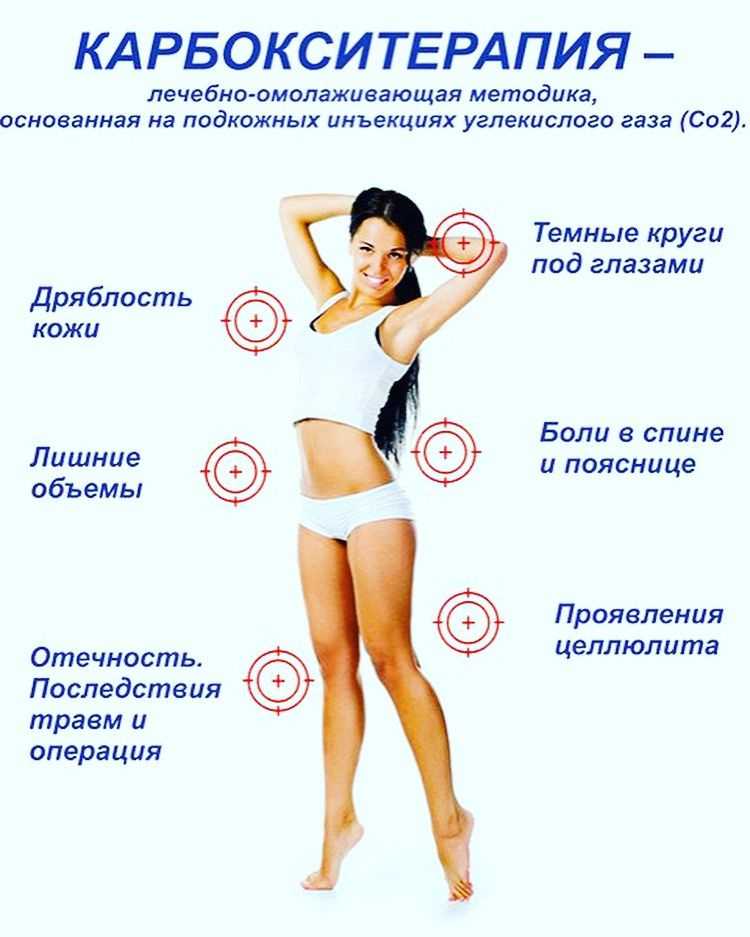Что такое выскабливание полости матки, когда назначается