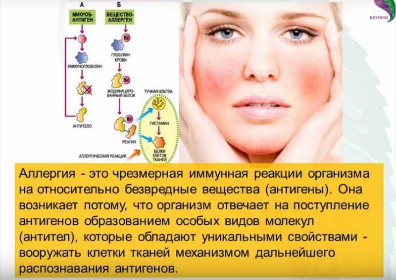 10 странных фактов об аллергии, которые стоит знать и абсолютно здоровым людям