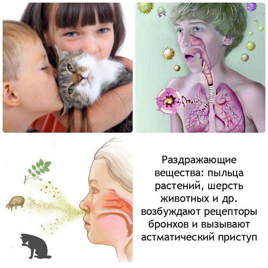 Что делать при аллергии на кошек: основные рекомендации и методы лечения – медицинский портал