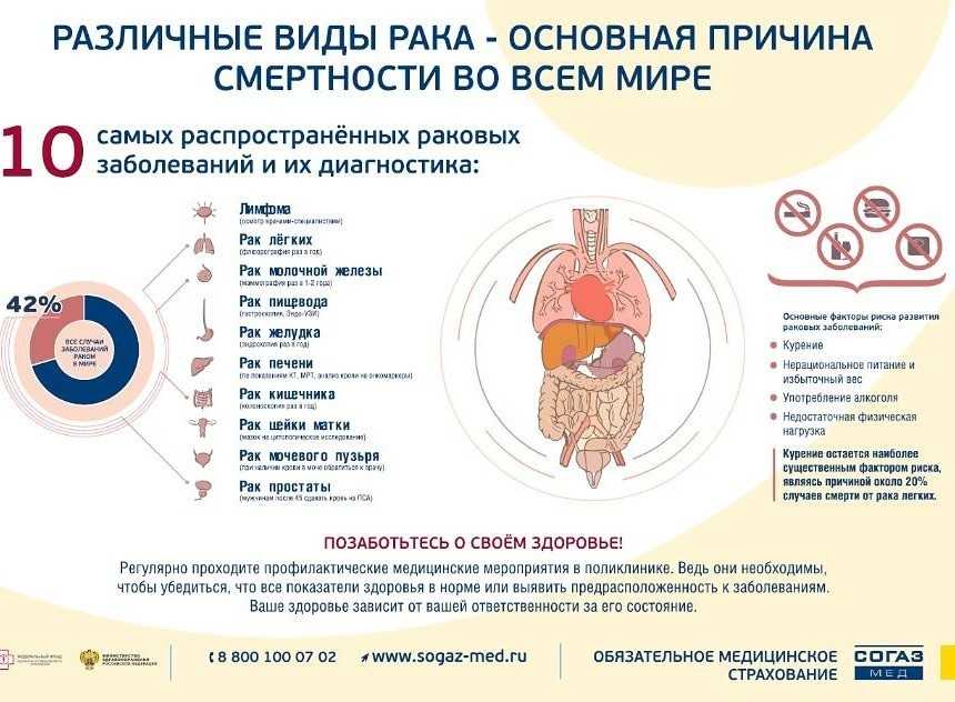Почему в стране не работает система выявления онкологии