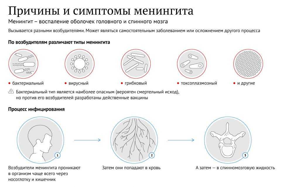Первые признаки менингита у детей и взрослых