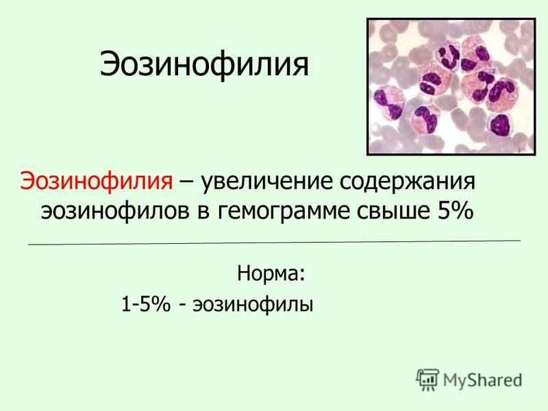 Анализ крови на эозинофильный катионный белок - что это