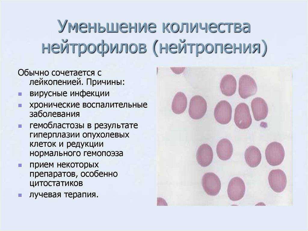 Нейтрофилы повышены у ребенка: 11 причин повышения, норма, подготовка к анализу