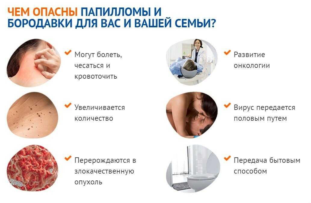 Появление папиллом и бородавок у детей