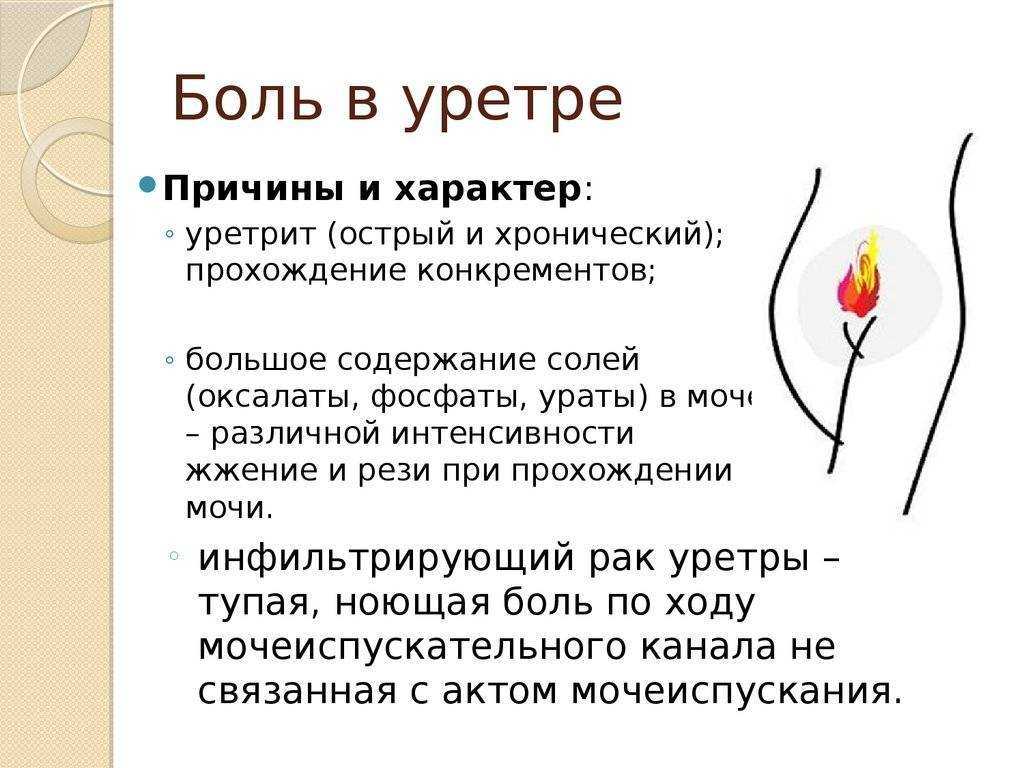 Истерический невроз