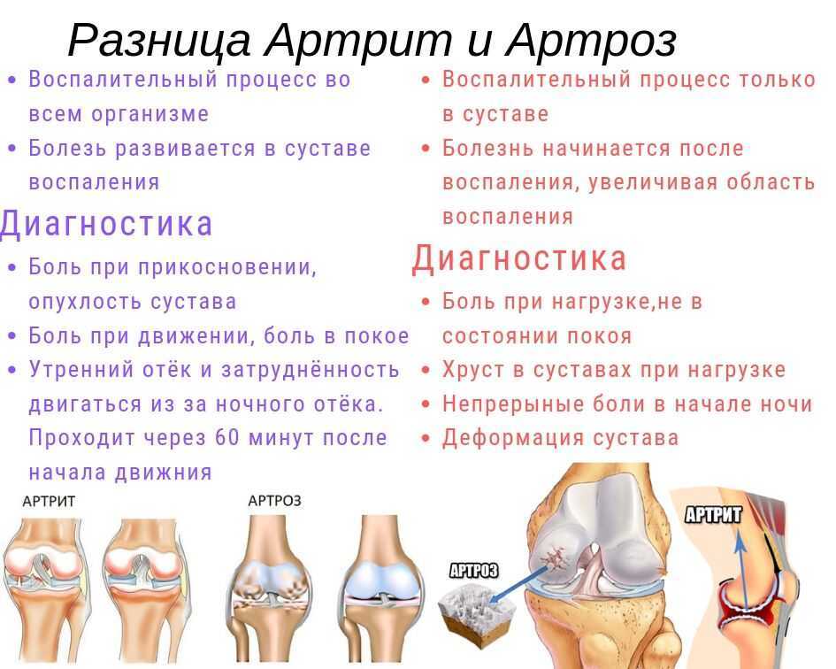 Вывихи бедренной кости в тазобедренном суставе (в т.ч. вывихи головки эндопротеза, эндопротезирование тазобедренного сустава, перипротезные переломы)