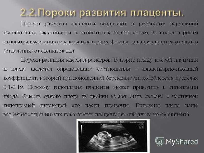 Маловодие
