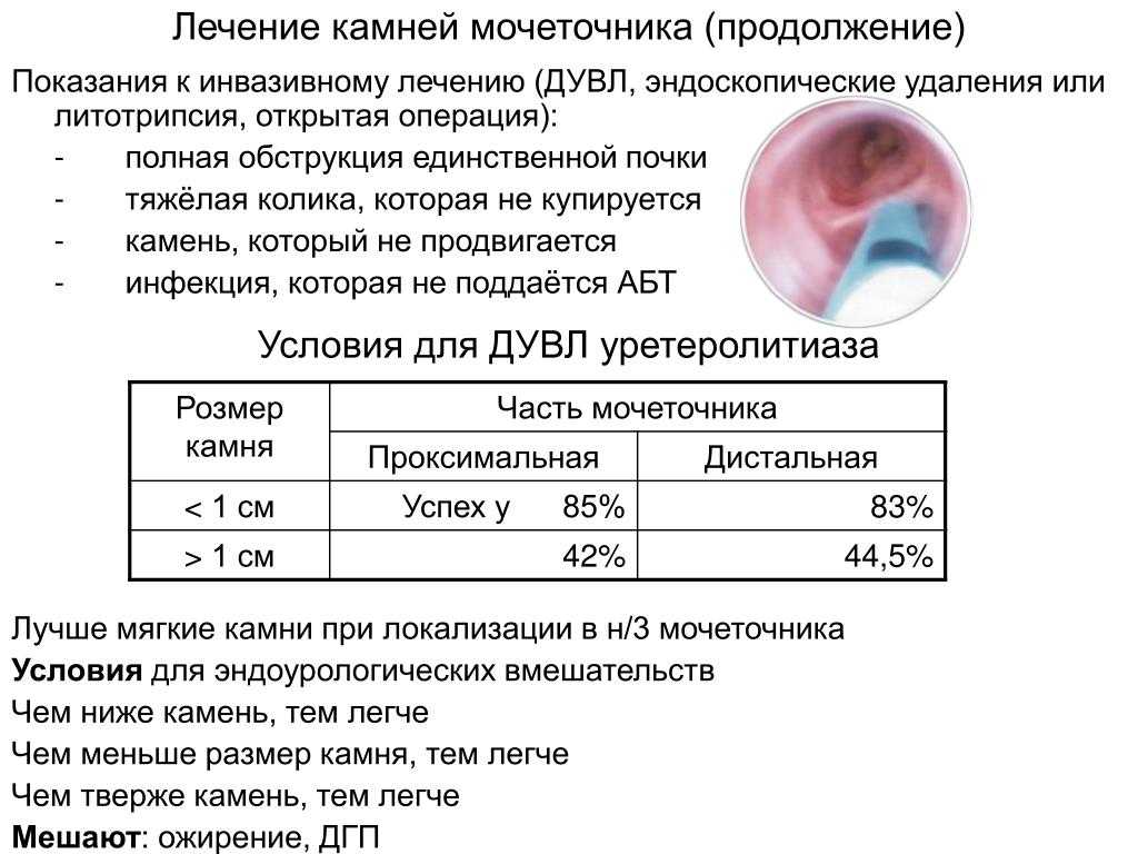 Песок и камни в почках, лечение мочекаменной болезни   - medside.ru