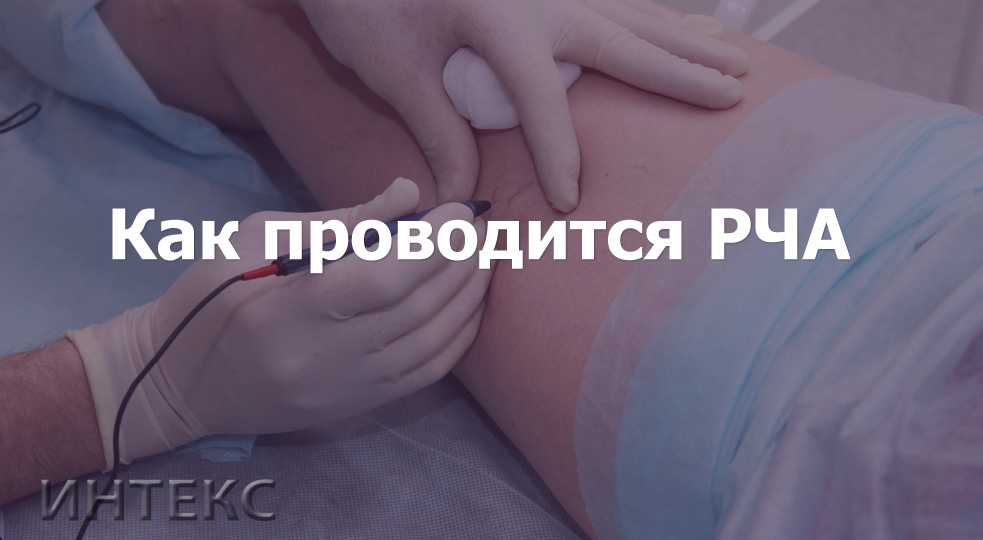 Шунтирование сердца: что это такое, как проходит операция, прогноз жизни