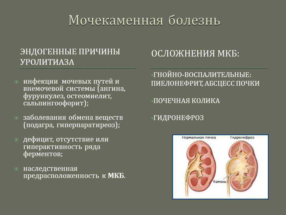 Камни в почках - причины, симптомы, диагностика, лечение и профилактика