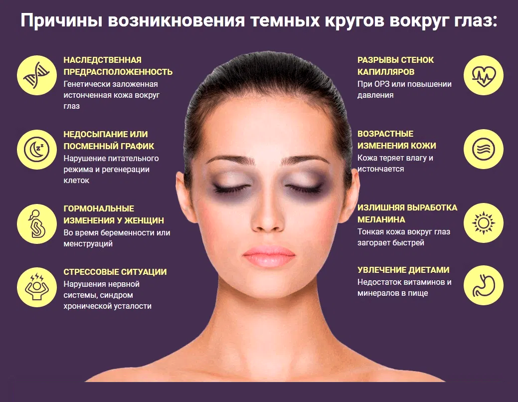Как убрать темные круги под глазами быстро, причины появления синяков под глазами
