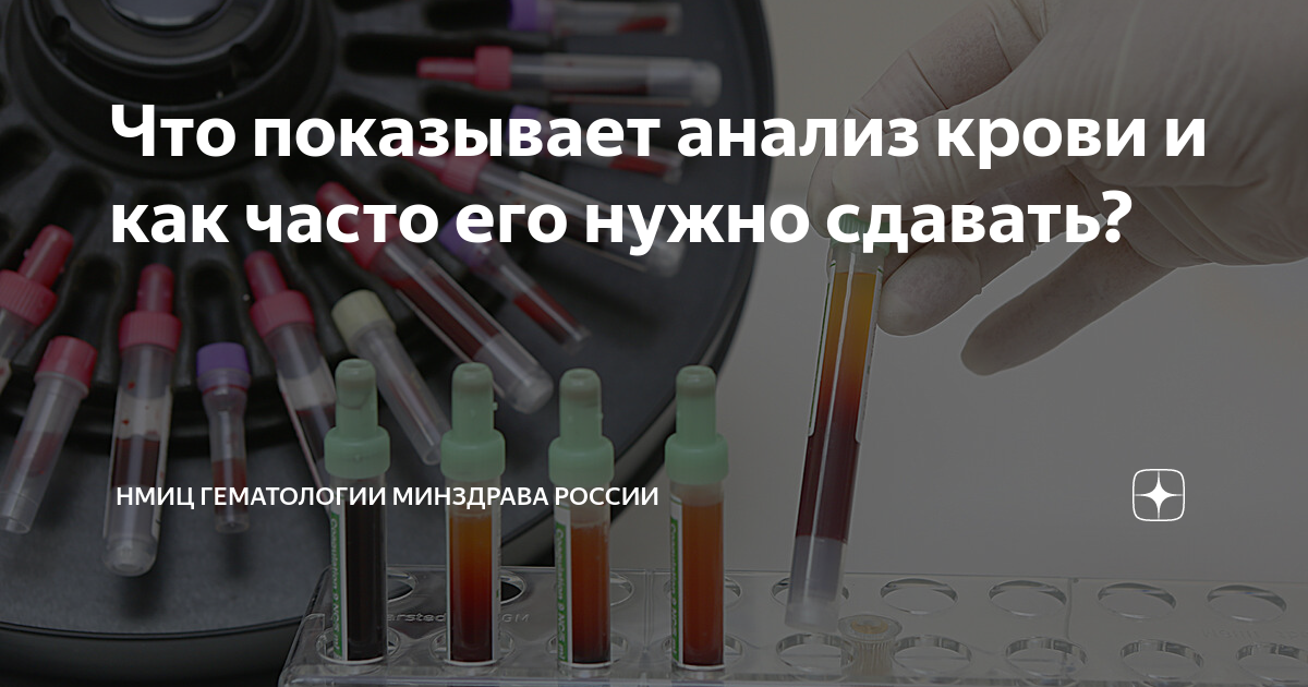 Топ анализов, которые нужно сдавать каждый год