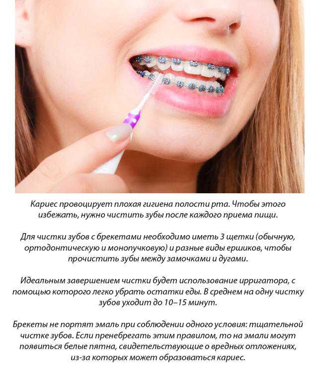 Ортодонтическое лечение - исправление неправильного прикуса