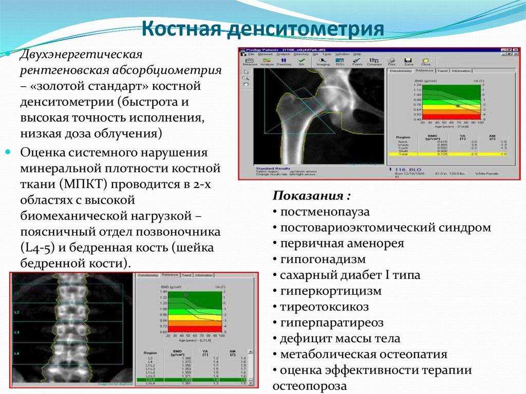 Денситометрия: кому и почему важно пройти это исследование костей?