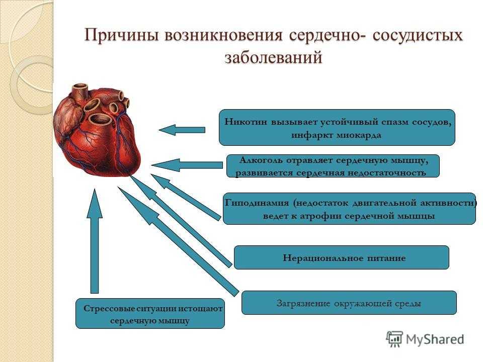 Сердечно-сосудистые заболевания: классификация, симптомы, диагностика
