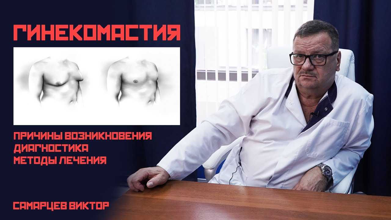 Гинекомастия - устранение увеличенных молочных желез у мужчин