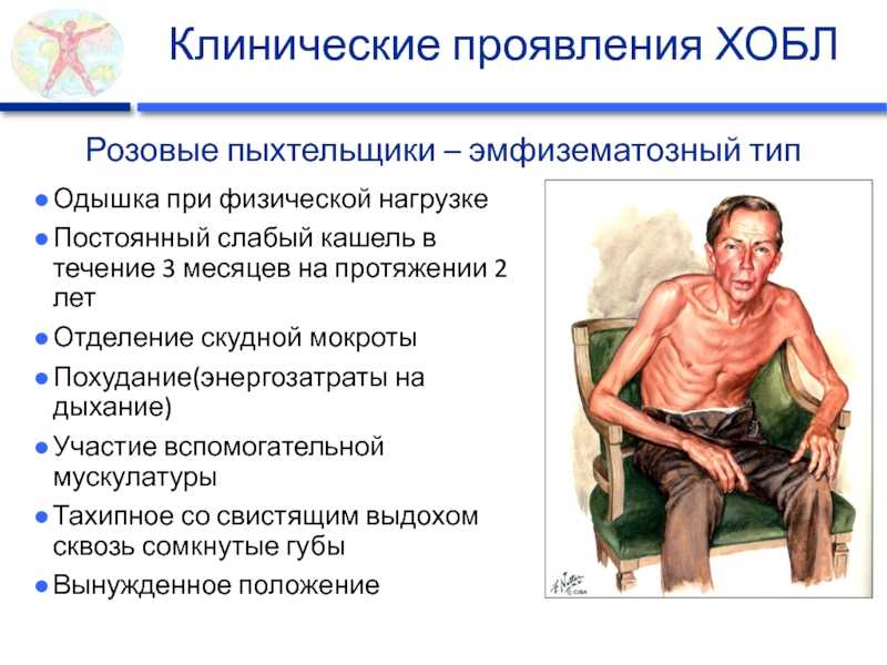 Одышка - причины, симптомы и лечение