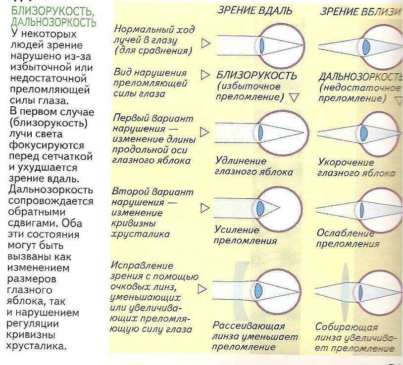 Всё, что надо знать о близорукости у детей