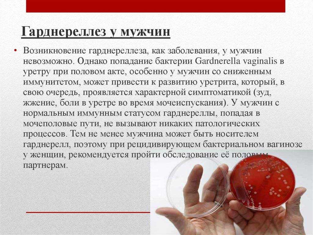 Лечение гарднереллеза у мужчин | клиника мужского здоровья