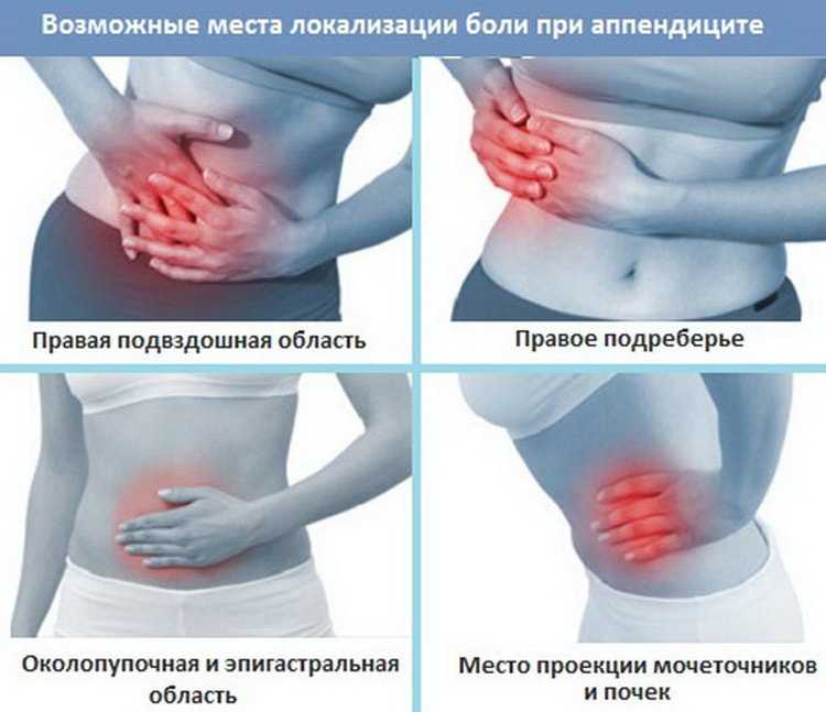 Аппендицит: симптомы и признаки – напоправку – напоправку