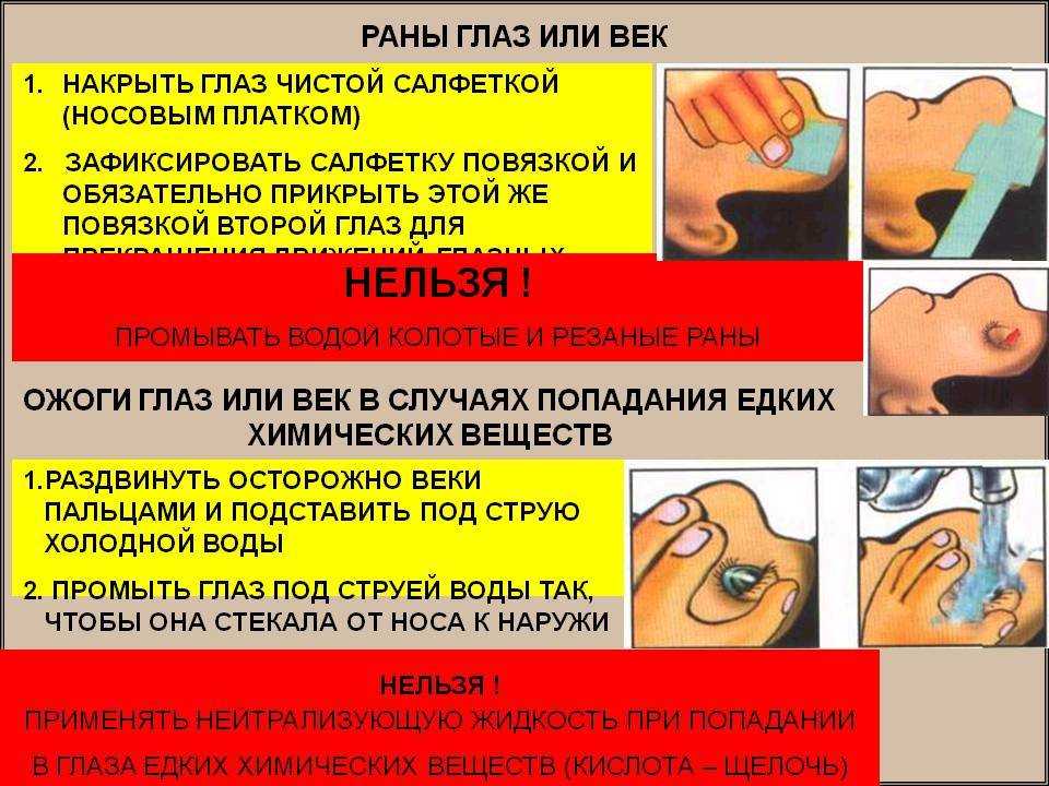 Конъюнктивит: причины, симптомы и лечение конъюнктивита