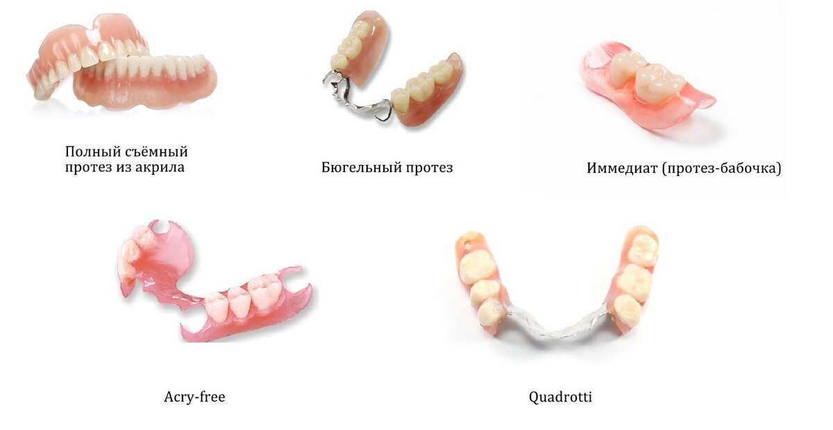 Съемный протез зубов какие бывают. Полносъемные протезы ортопедическая стоматология. Съемный бюгельный протез (1 челюсть). Бюгельные протезы иммедиат. Съемный пластинчатый протез (1 пластина).
