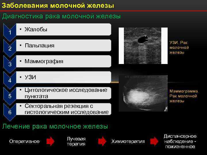 Рак молочной железы 2 стадии: лечение и перспективы – lifekorea.ru