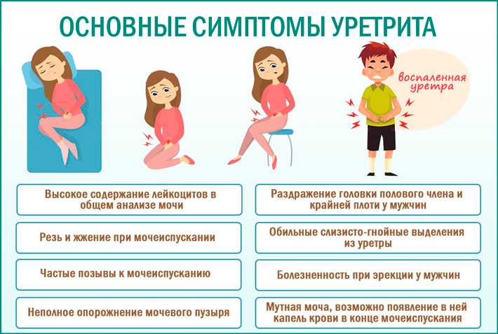 Лечение уретрита - воспаления уретры у женщин
