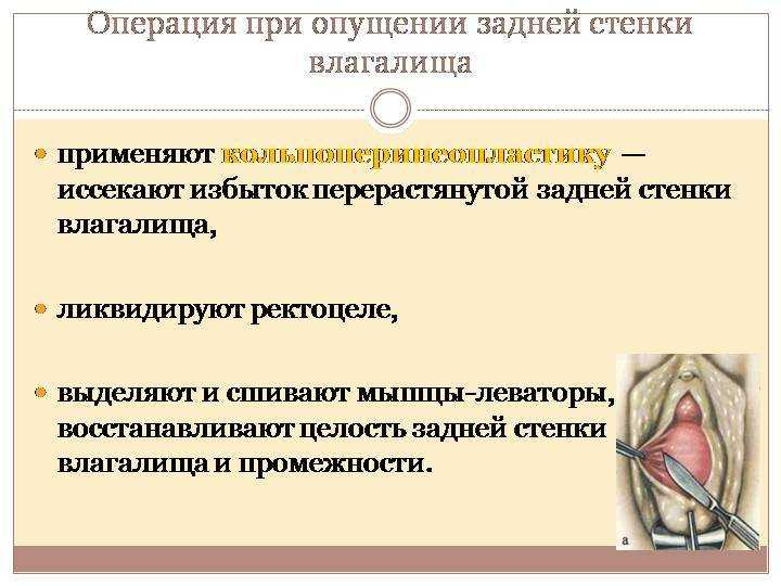Несостоятельность мышц тазового дна. причины, симптомы и лечение!