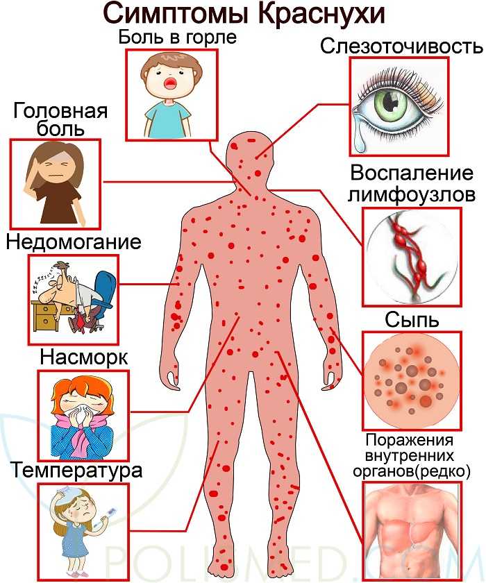 Аллергия у ребенка