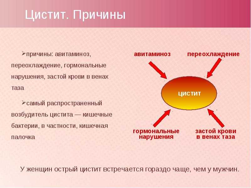 Цистит: что это, причины, лечение, симптомы
