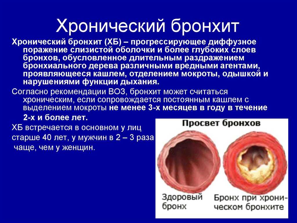 Карта вызова смп хронический бронхит обострение у взрослых