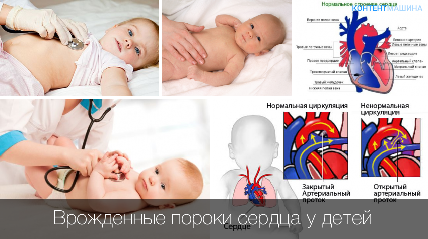 ᐈ чем опасен порок сердца? ~【диагностика и лечение в киеве】