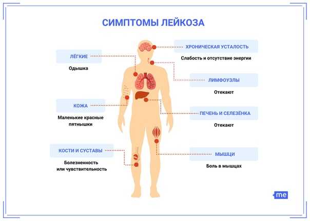 Какие показатели общего анализа крови указывают на онкологию — лаб-синтез диагностик