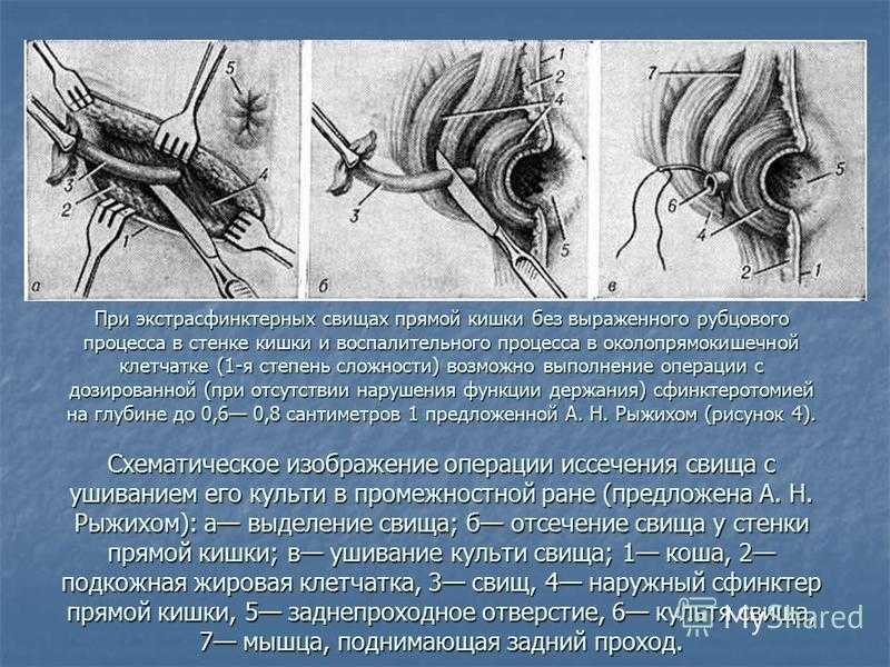 Слезятся глаза и насморк: причины почему это бывает без температуры, что делать для лечения у взрослого и ребенка