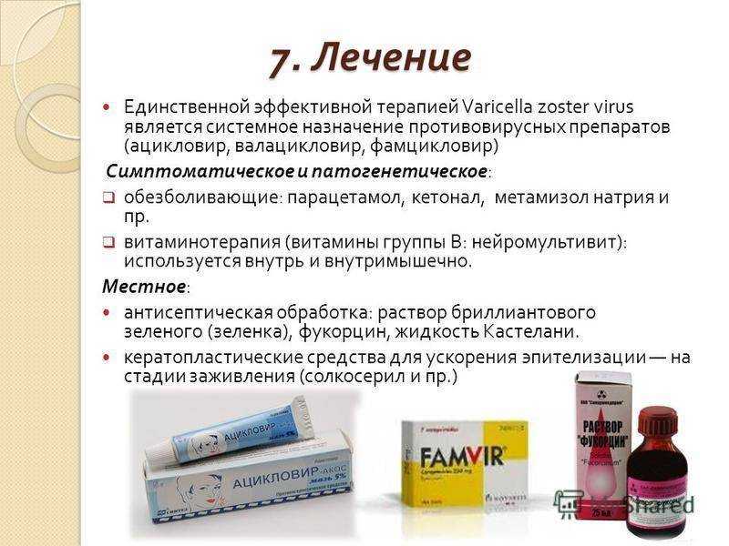 Что будет, если прижечь папилломы йодом? | атлантик