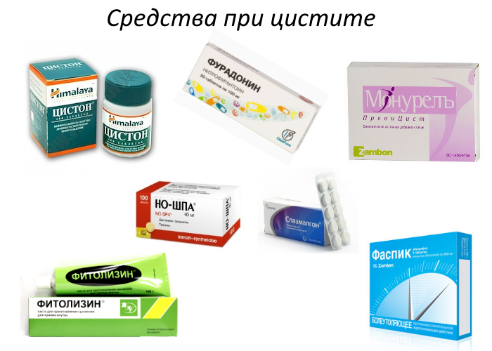 Как лечить уретрит у женщин: симптомы, лечение и препараты