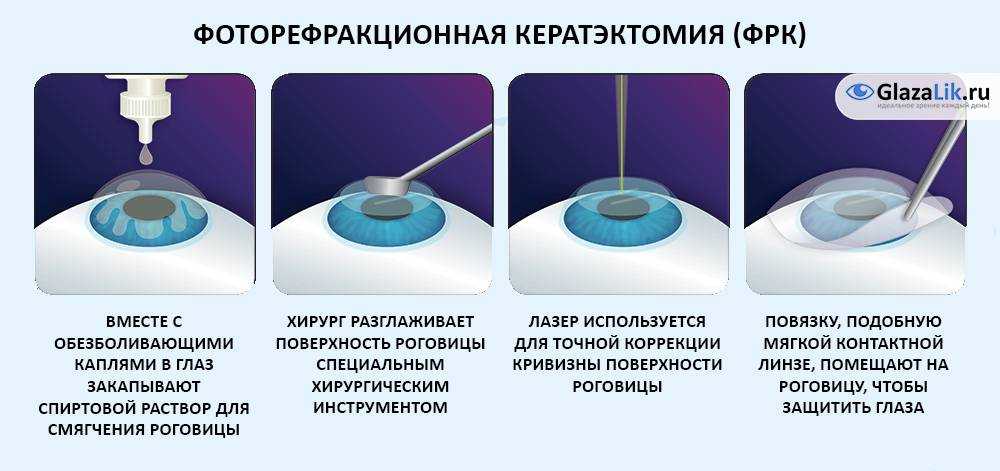 Лазерная блефаропластика - как проводится, последствия, отзывы