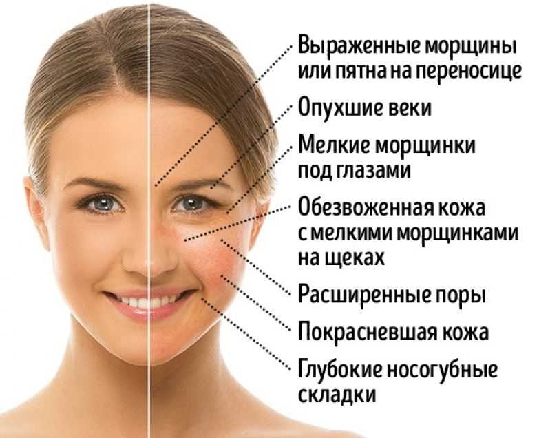 Безглютеновые продукты: список на заметку!