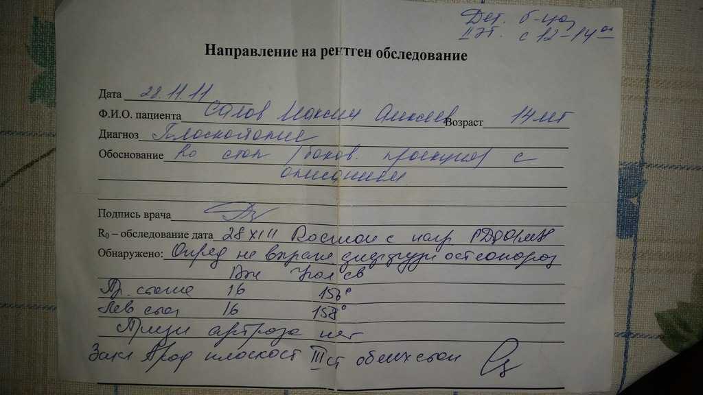 Френулопластика