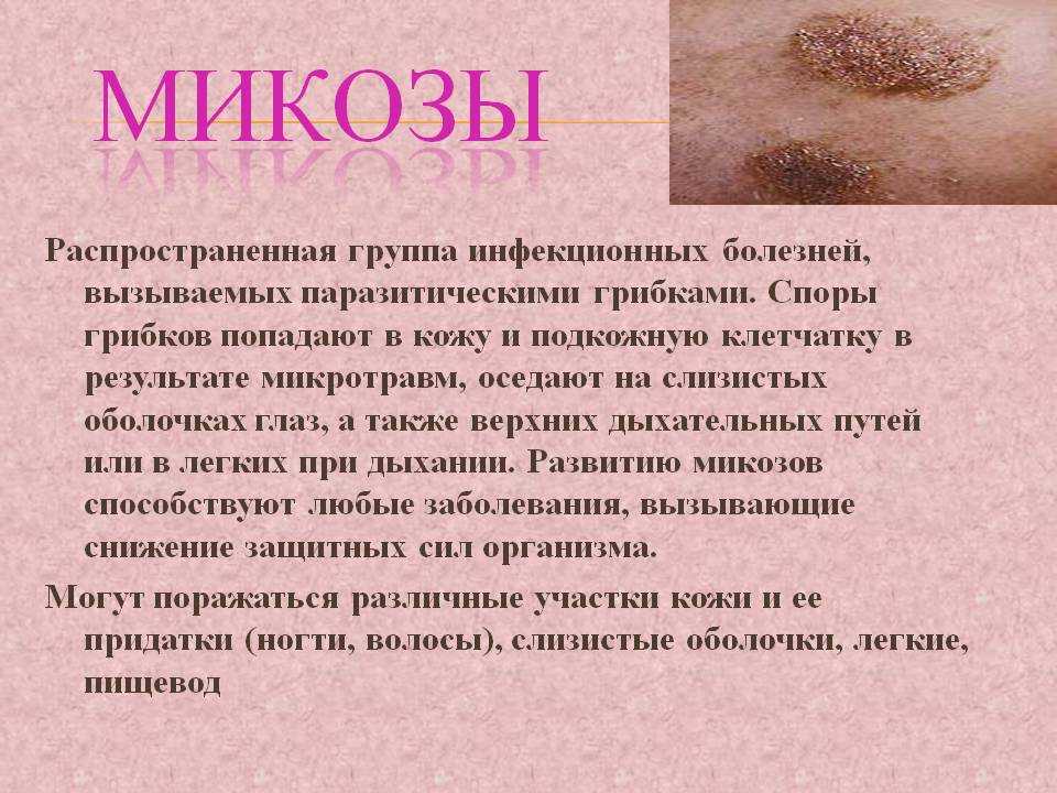 Стригущий лишай у ребенка: симптомы и лечение микроспории