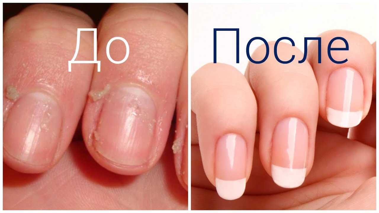9 правил домашнего ухода за кутикулой