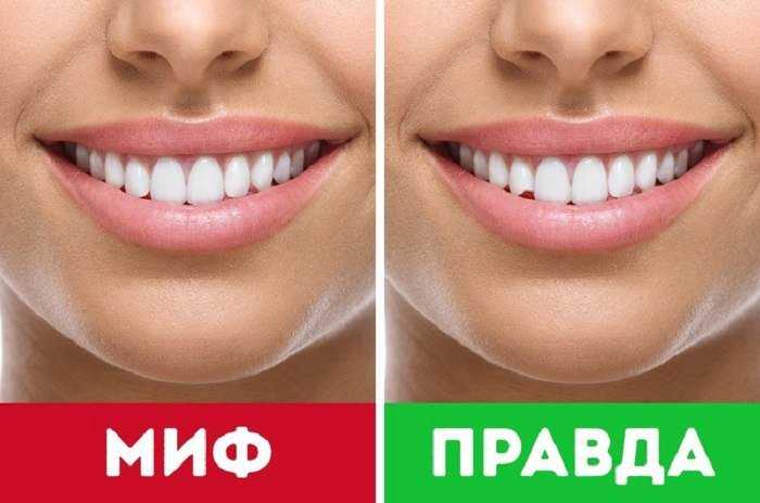 Как научиться красиво улыбаться? секреты правильной улыбки с зубами